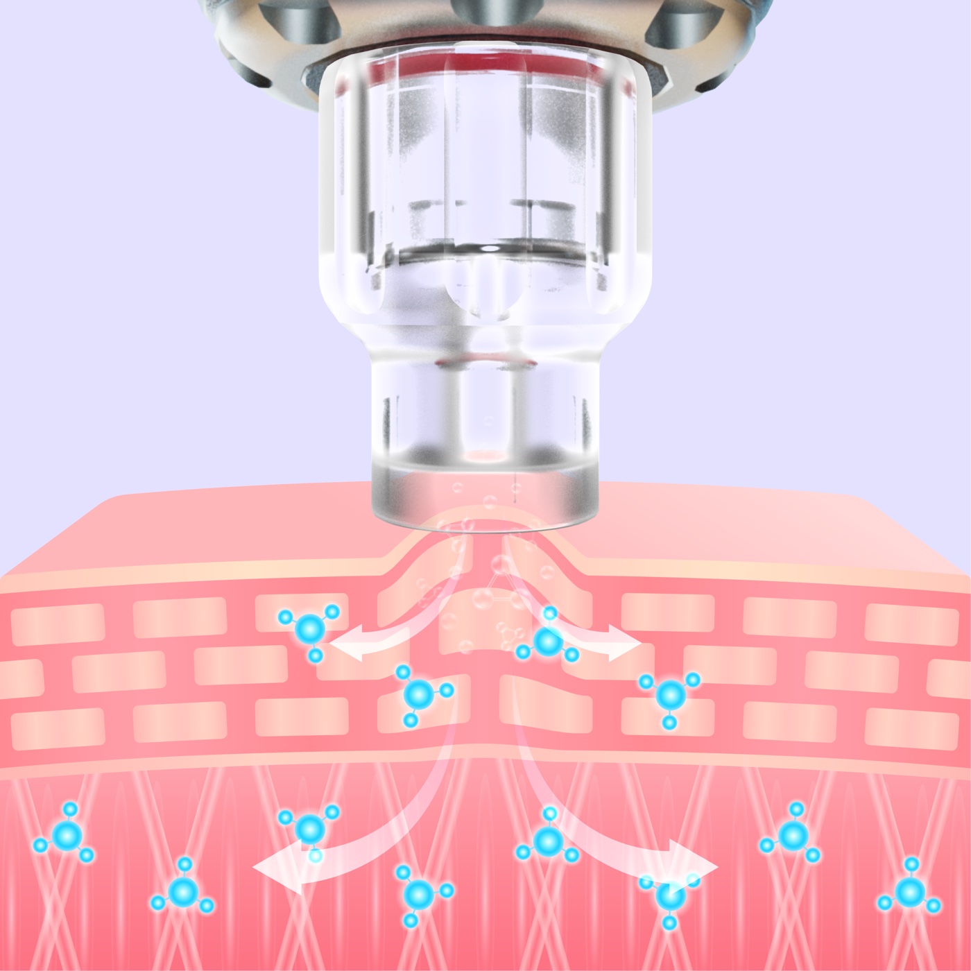 Skin Tip